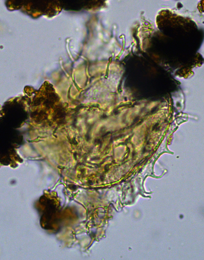 Wetzeliella meckelfeldensis Wmec27X1139141145989a.jpg